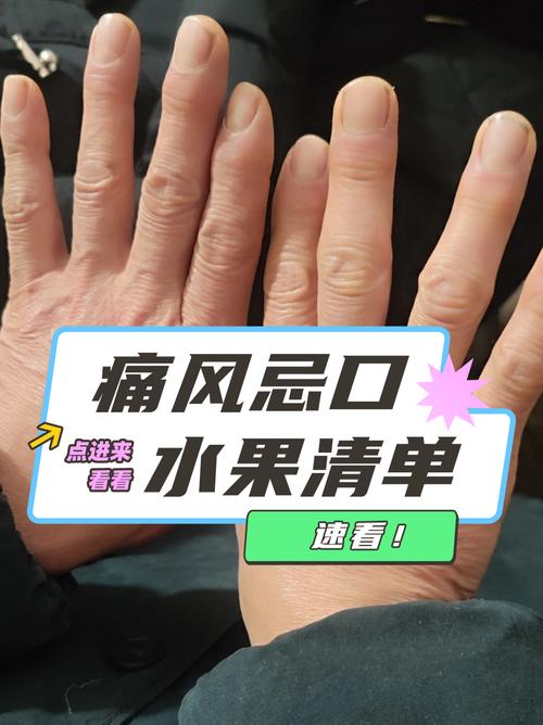 痛风有哪些东西不能吃