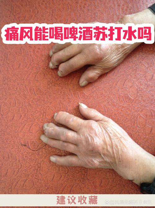 痛风喝哪个牌子苏打水