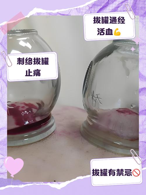 针灸拔罐后能喝酒吗