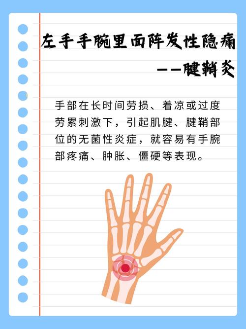 怎么判断手腕疼是痛风