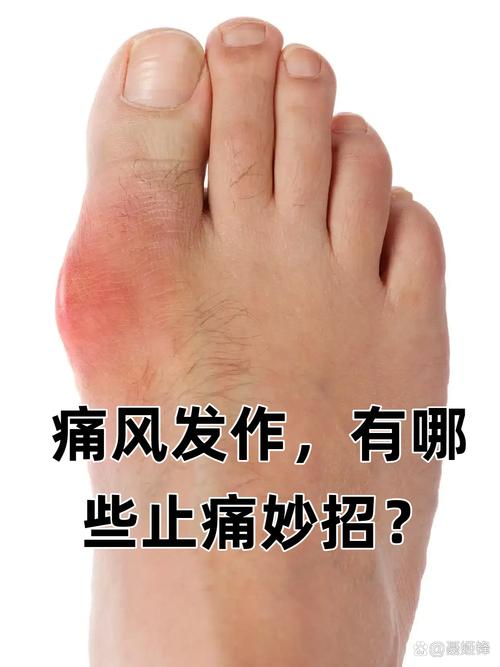 痛风的症状表现有哪些