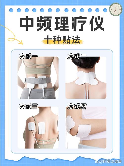 怡达理疗仪针灸贴片