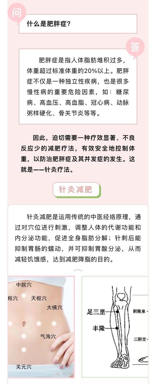 瘦安针灸减肥怎么样