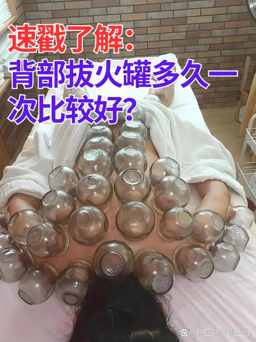 针灸拔罐有副作用吗