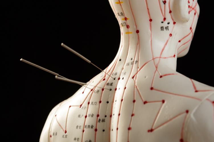 张浦郭氏针灸怎么样