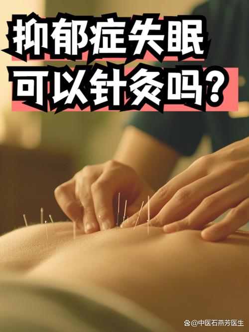 针灸能治神经衰弱吗