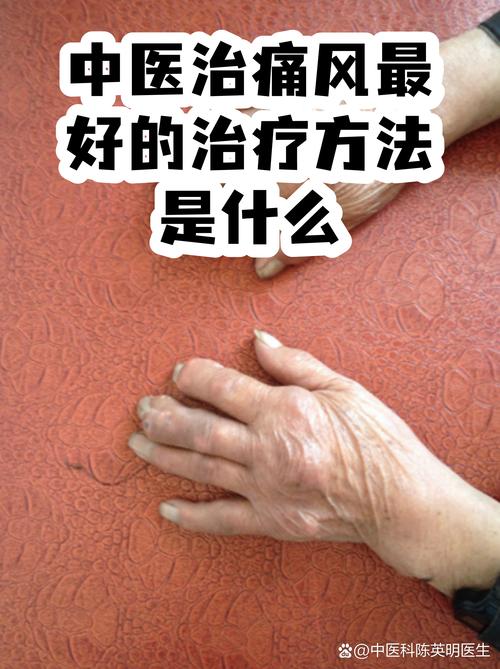 中医院治痛风怎么样
