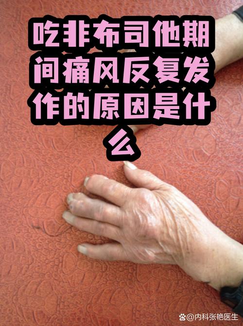 痛风发作期非布司他