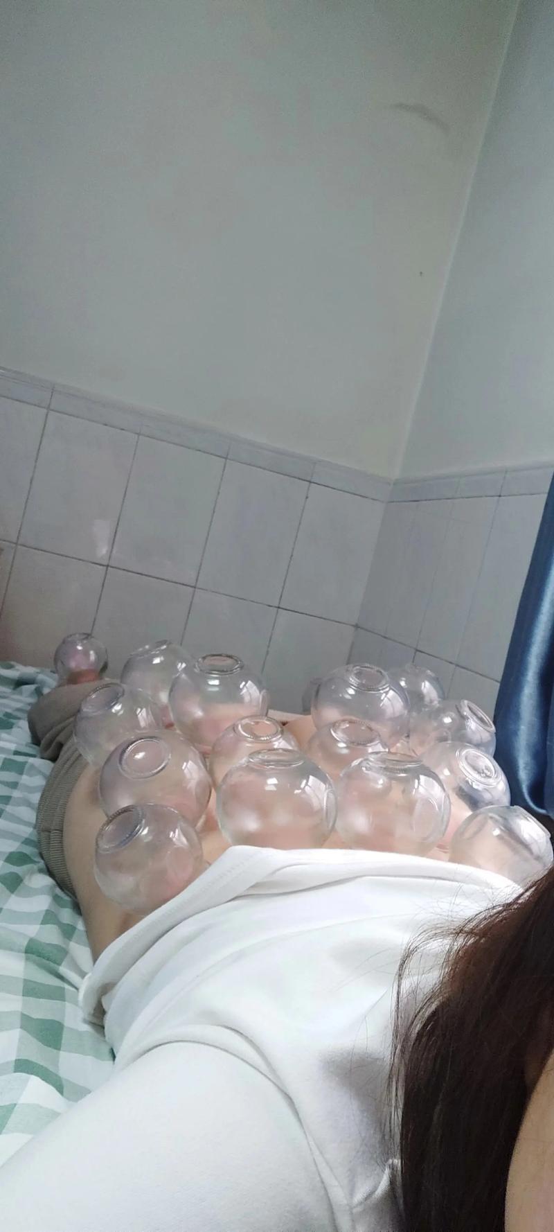 天津针灸拔罐哪里好