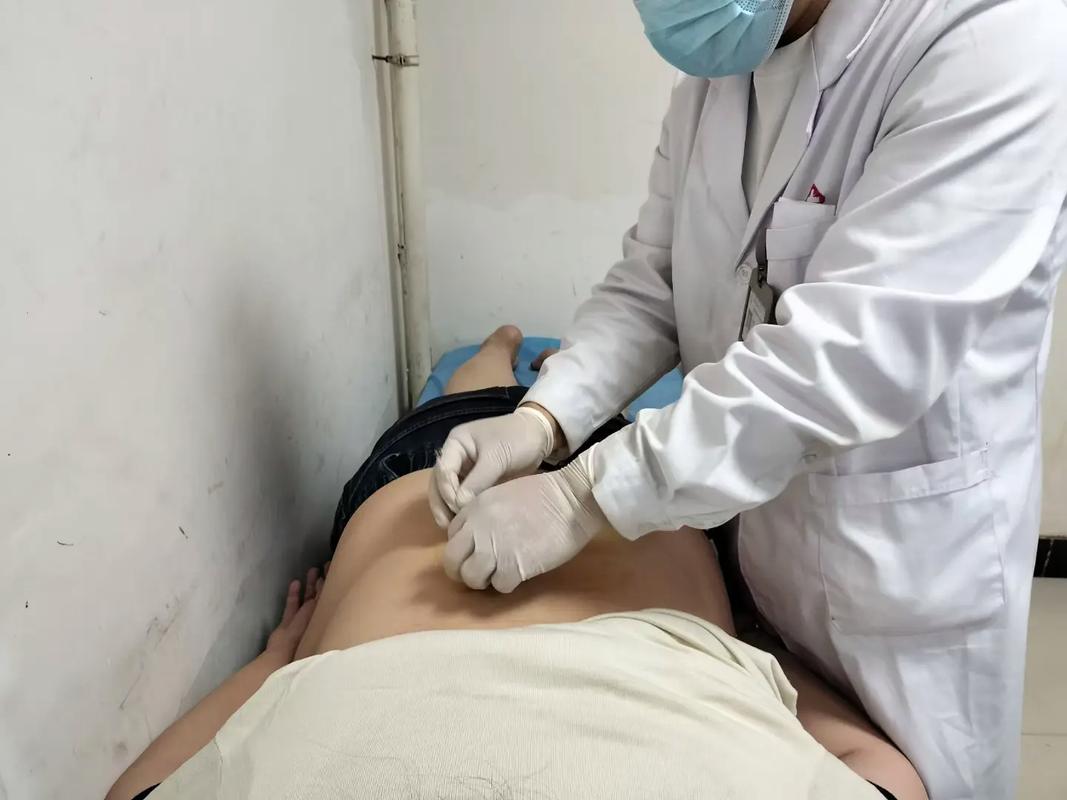 宣武中医院针灸减肥