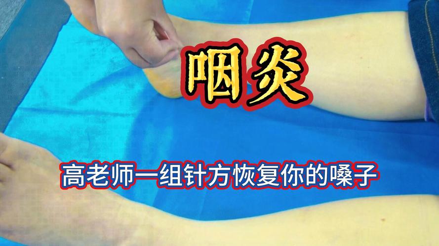 急性咽炎的针灸疗法