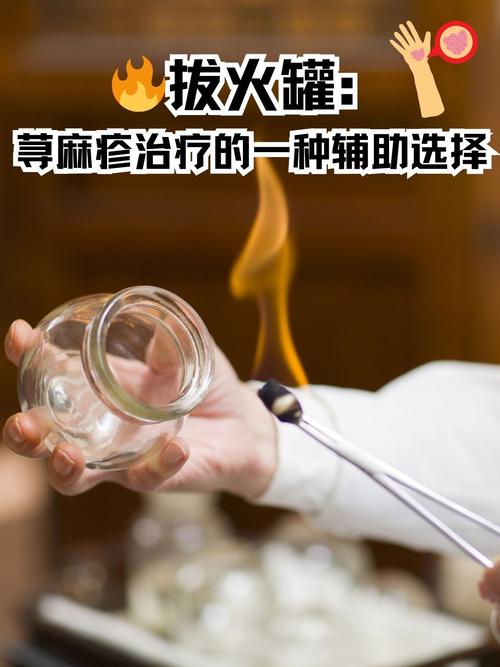 拔血罐能治疗痛风吗