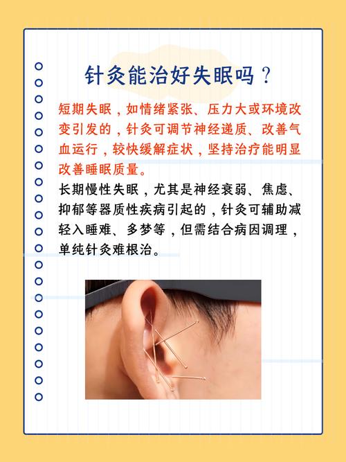 失眠做针灸有效果吗