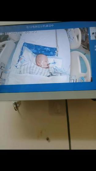 早产儿激素脱氧安全吗