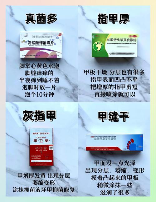 口服灰指甲最安全的药