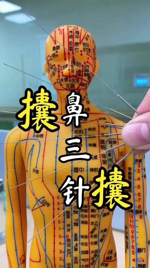 鼻炎做针灸有效果吗