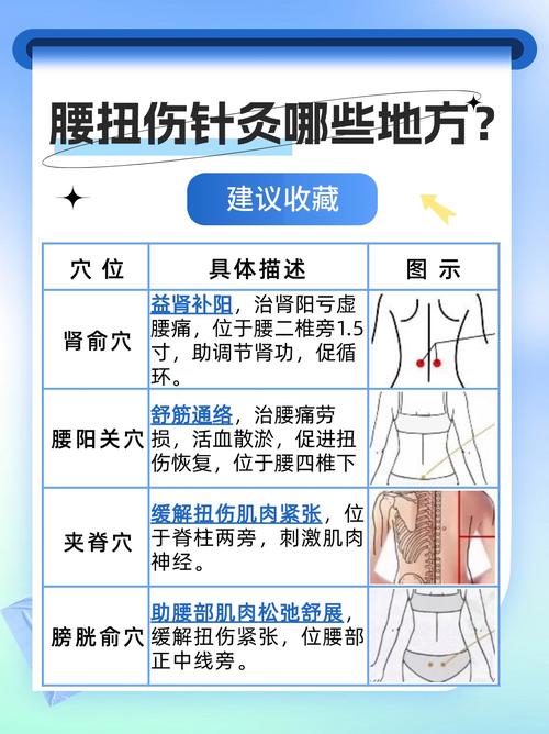腰扭伤可以做针灸吗
