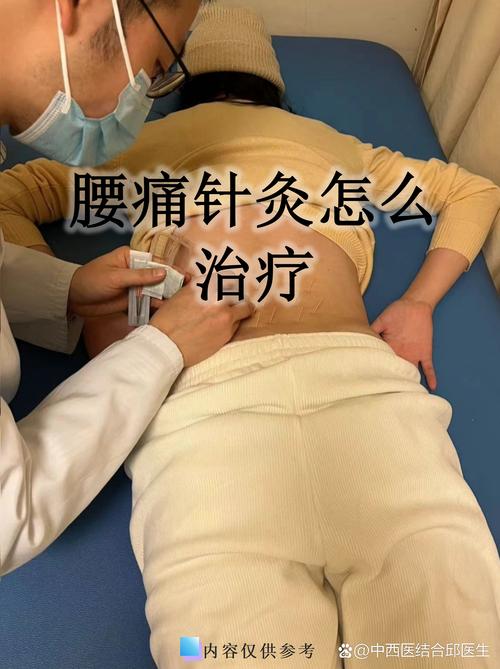 腰扭伤可以做针灸吗