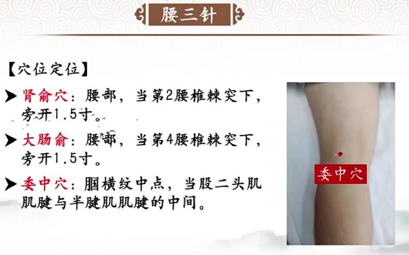 腰扭伤可以做针灸吗