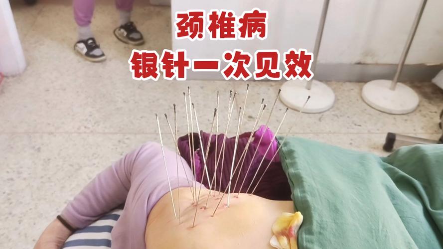 颈椎病针灸能否治好
