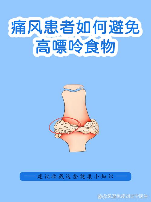 痛风发作时能洗澡么