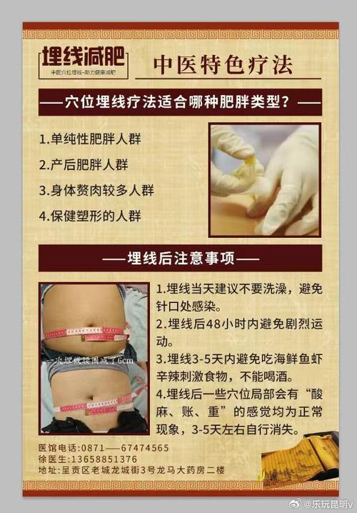 针灸埋线有什么好处