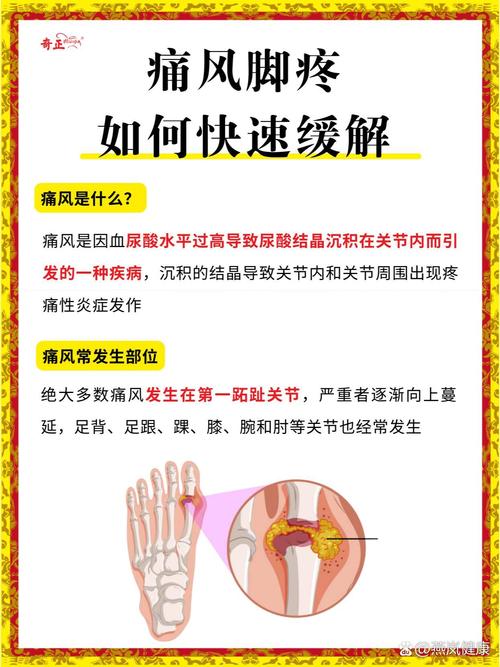 脚脖子筋疼是痛风么