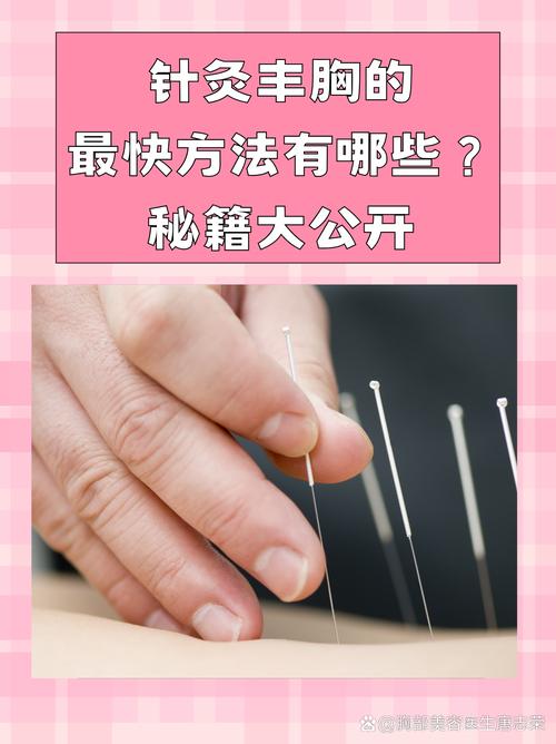 针灸可以自己拔针吗
