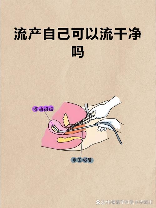 做人流哪种最好最安全