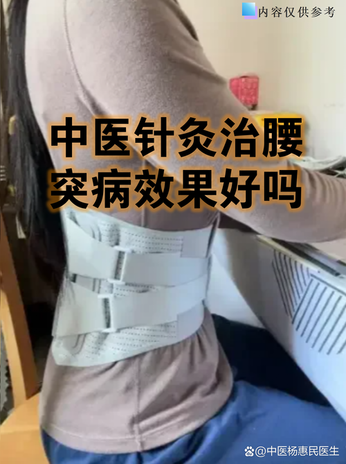 针灸治腰疼几次能好