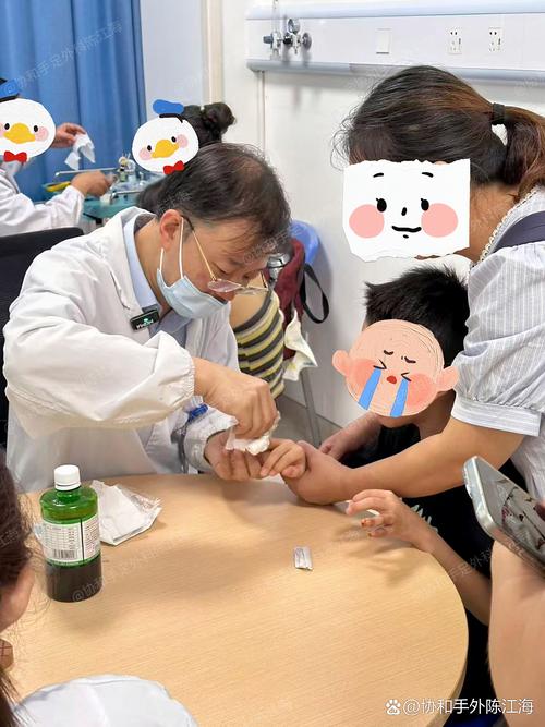 针灸治疗儿童近视眼