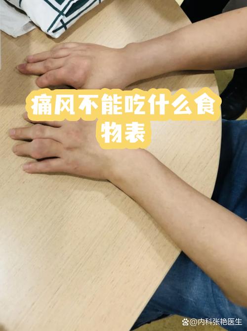 手关节痛风吃什么好