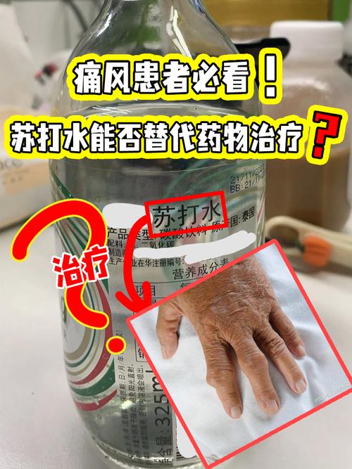 喝苏打水能治疗痛风