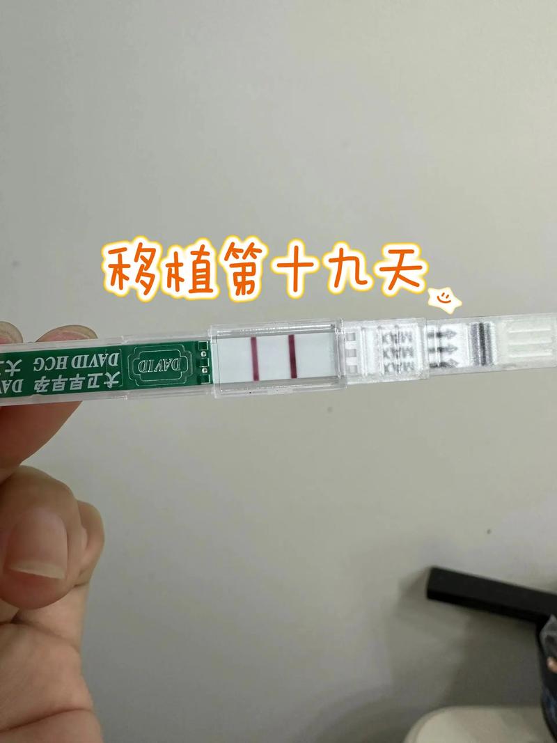 移植十九天是否安全了