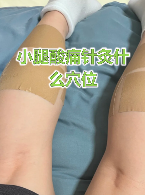 小腿针灸埋线部位肿