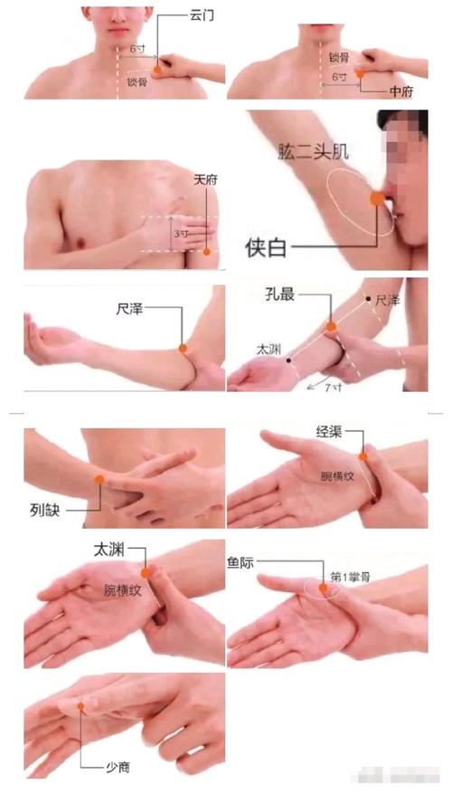 针灸扎到肺怎么治疗