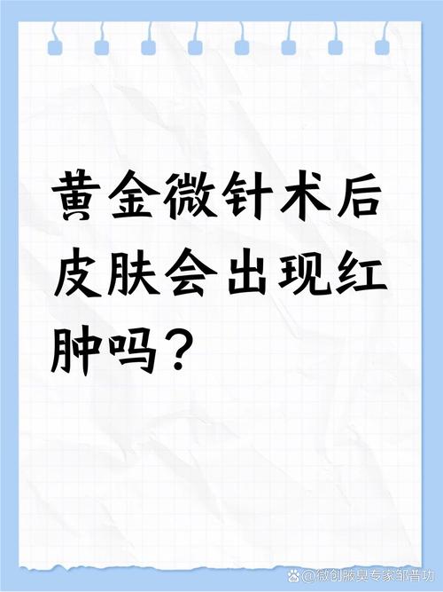 扎针灸会引起血肿吗