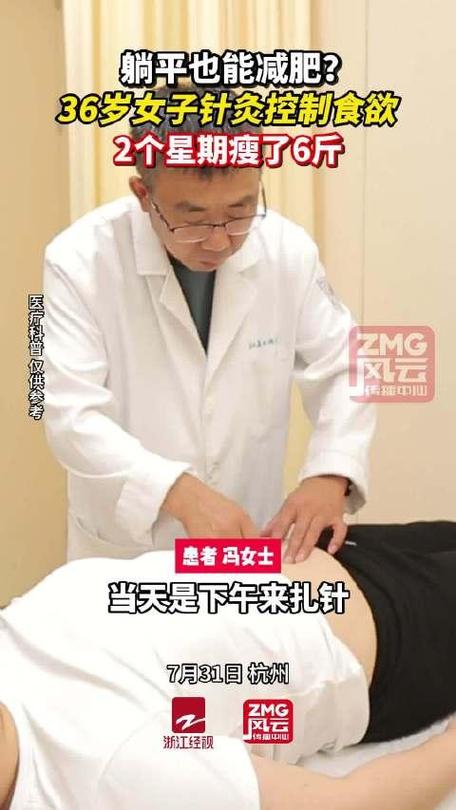 针灸减肥用几寸的针