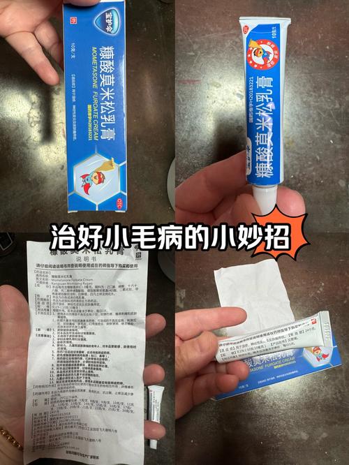 复方氟米松软膏安全吗