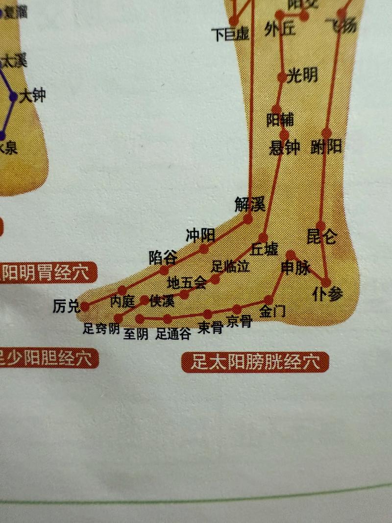 扭伤脚踝针灸治疗吗