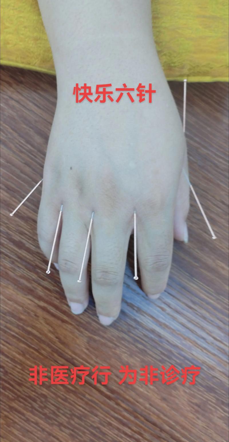 手心针灸是治什么病