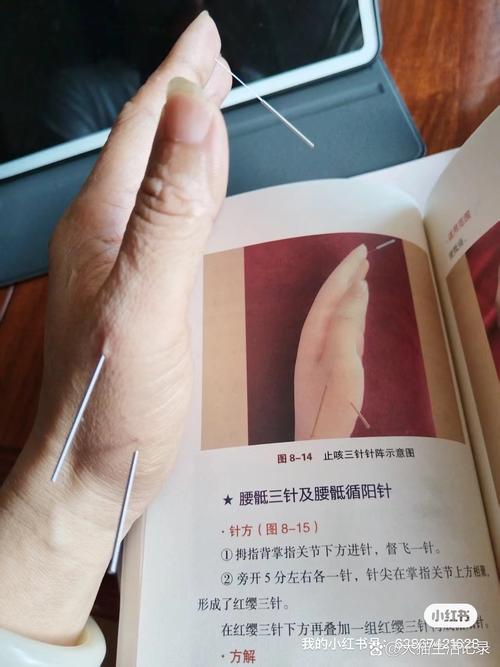倪海厦针灸视频48