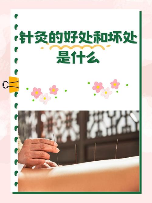 理疗和针灸都要做吗