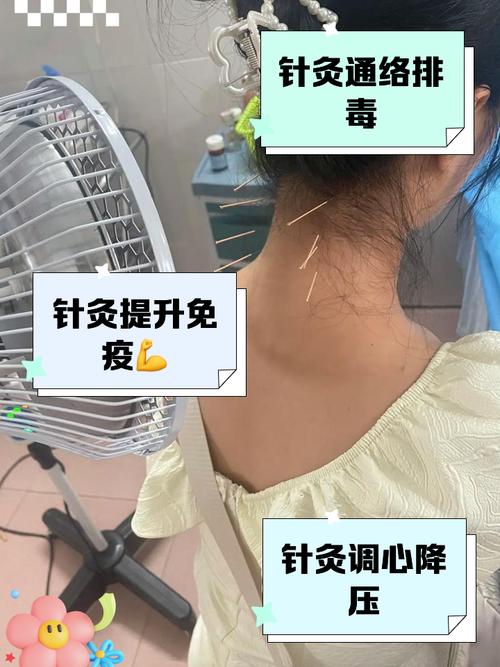 隐形针灸有副作用吗