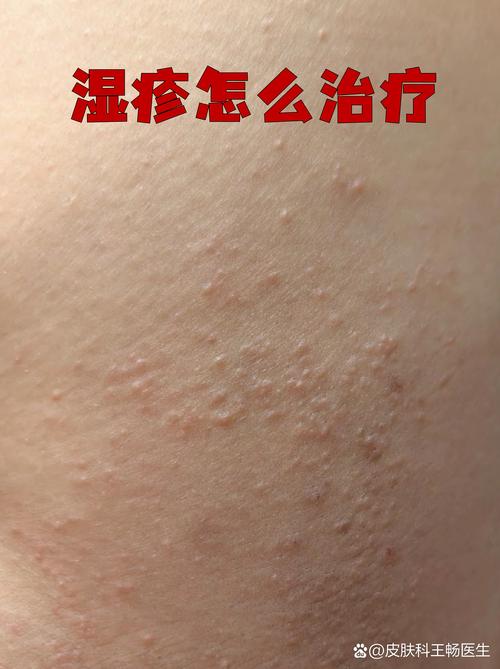 重庆皮肤病太医堂安全