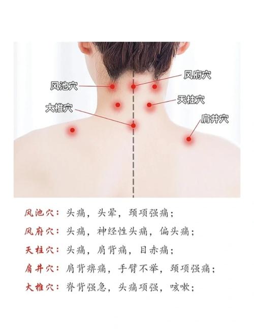 偏头痛如何针灸治疗