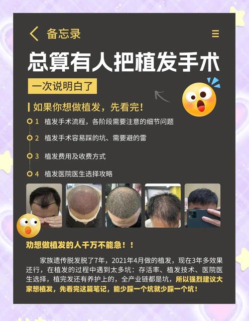 植发费用海峡植发安全