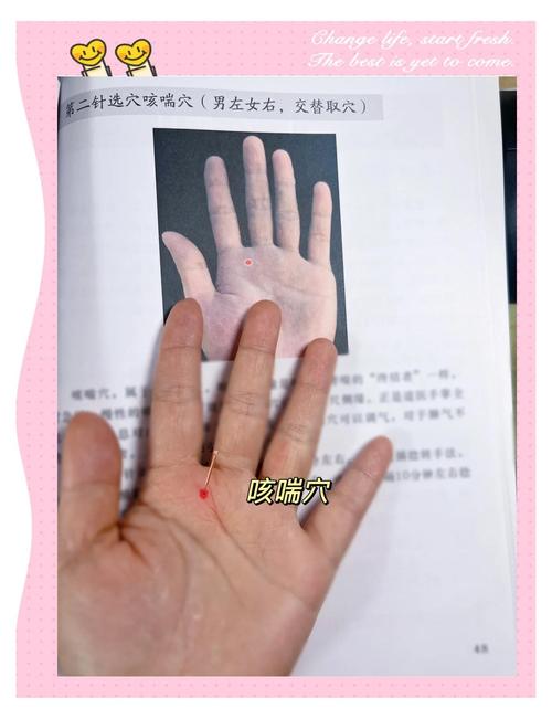 咽喉炎针灸治疗方法