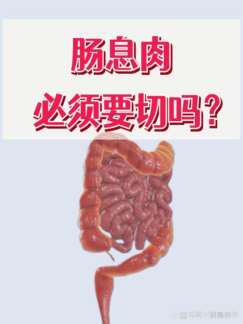 扁平状肠息肉最安全了