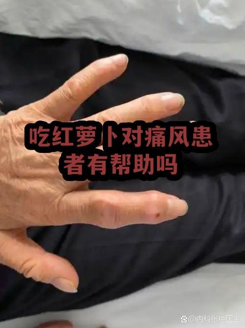 痛风病吃什么蔬菜好